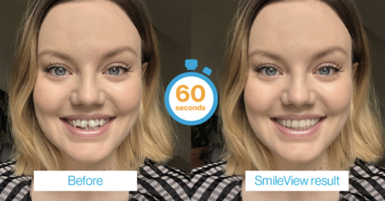 Upload a selfie and see your new smile in 60 seconds!