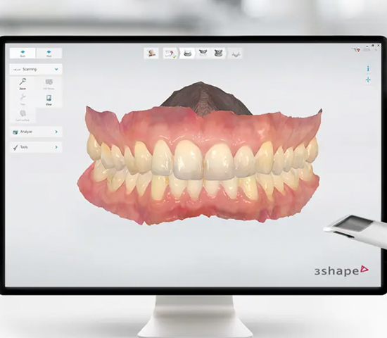 CBCT x-ray and Digital Scanning